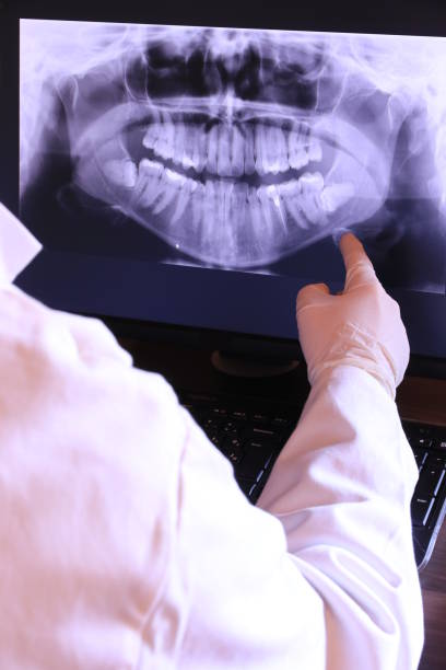Best Emergency Dentist for Knocked-Out Tooth in San Carlos Park, FL