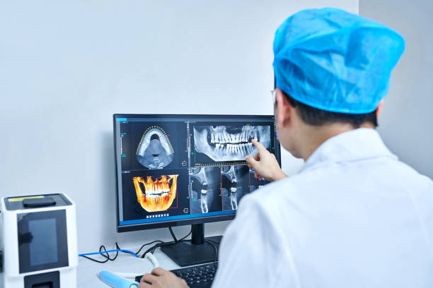 Best Emergency Dental Extractions in San Carlos Park, FL